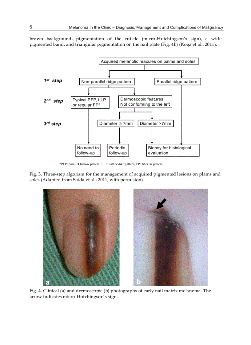 image for page Melanoma in the Clinic Diagnosis Management and Complications of Malignancy