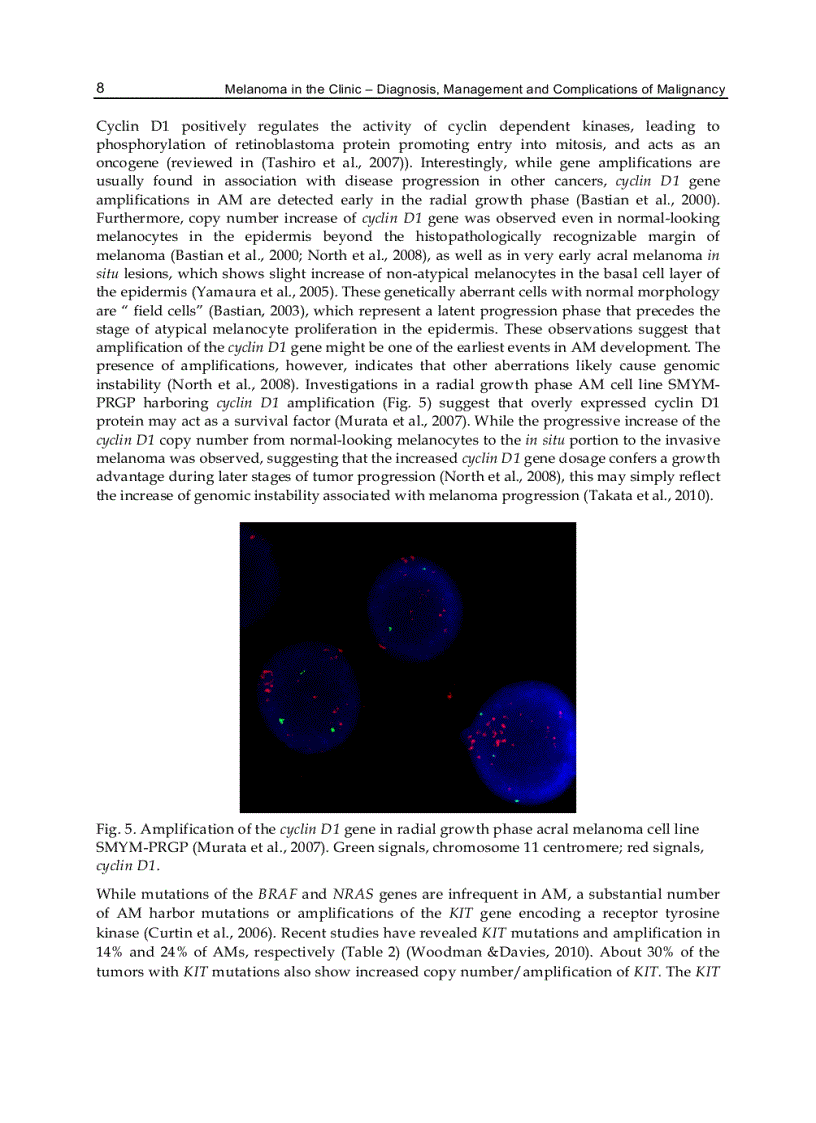 image for page Melanoma in the Clinic Diagnosis Management and Complications of Malignancy