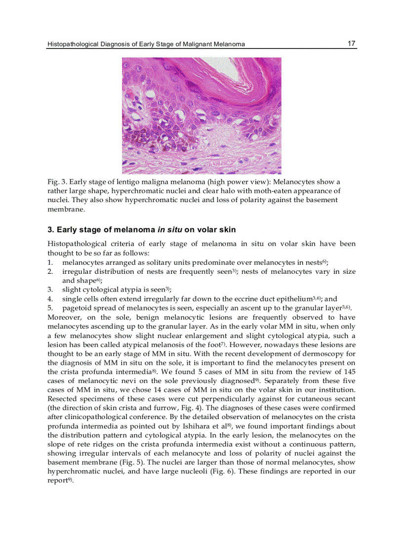 image for page Melanoma in the Clinic Diagnosis Management and Complications of Malignancy