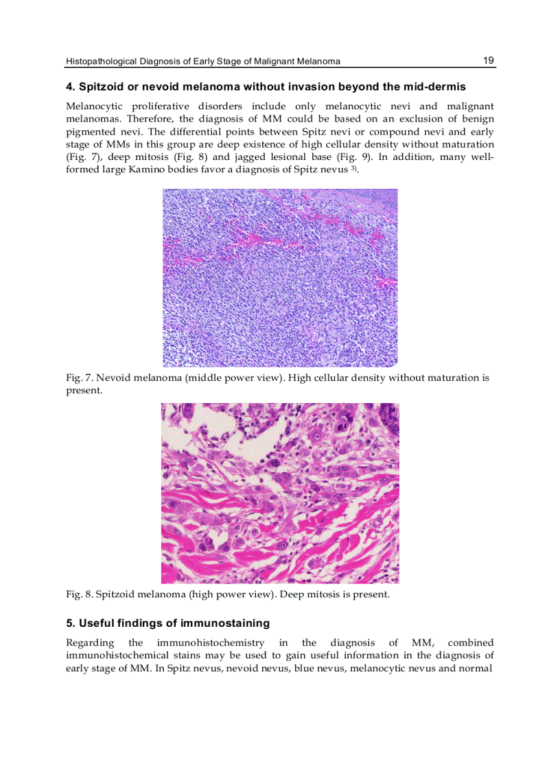 image for page Melanoma in the Clinic Diagnosis Management and Complications of Malignancy