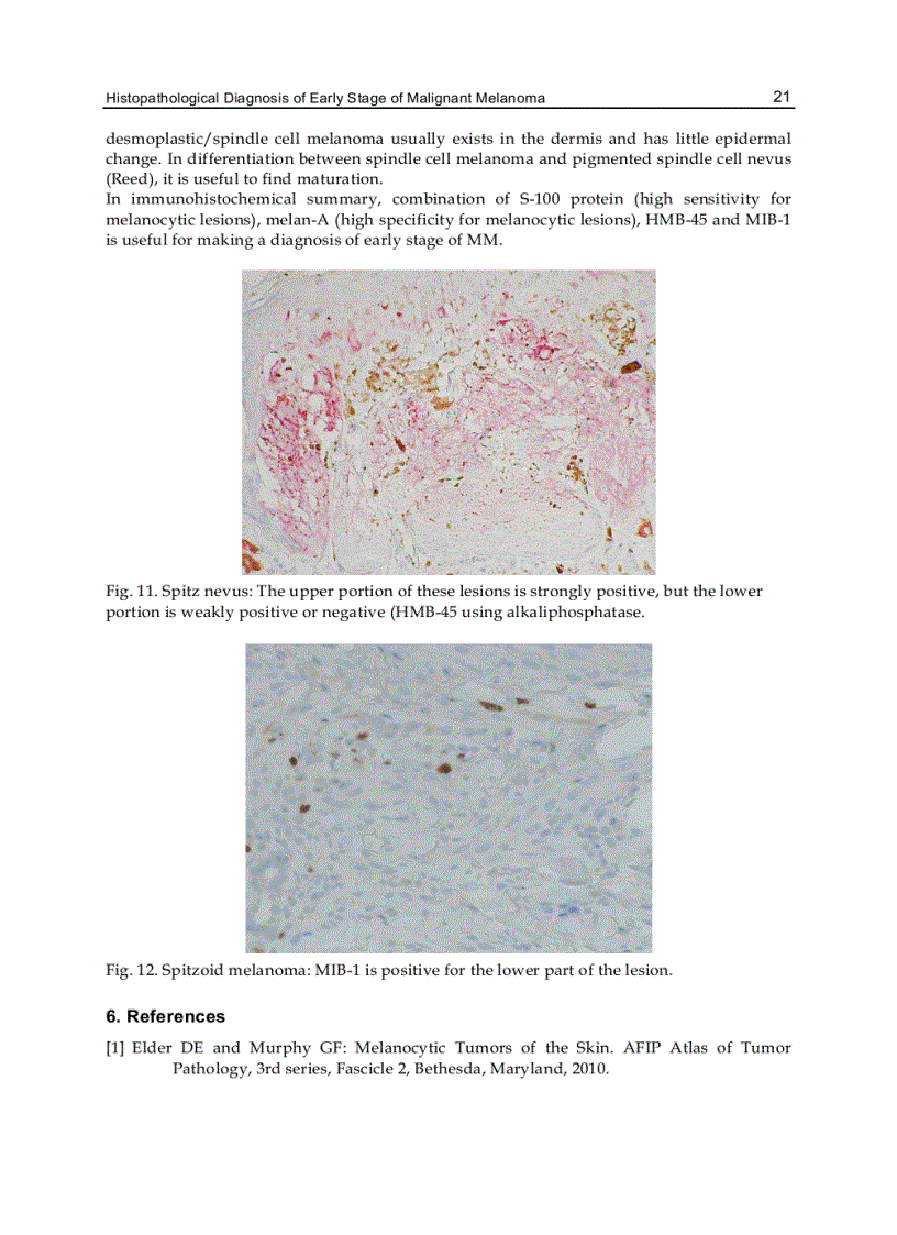 image for page Melanoma in the Clinic Diagnosis Management and Complications of Malignancy