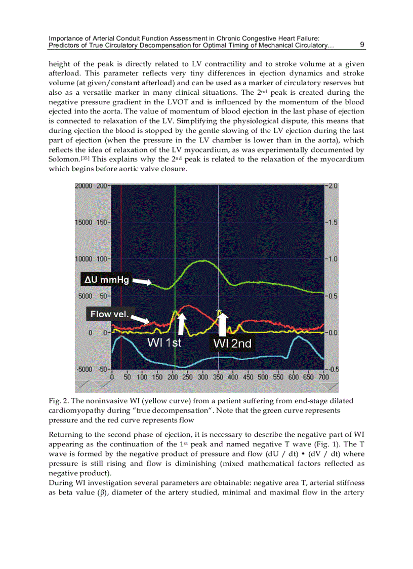 image for page New Aspects of Ventricular Assist Devices