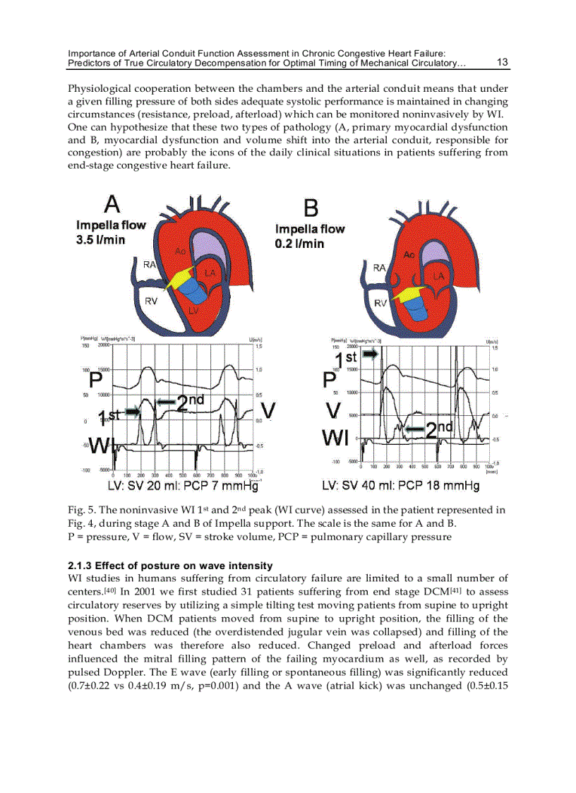 image for page New Aspects of Ventricular Assist Devices