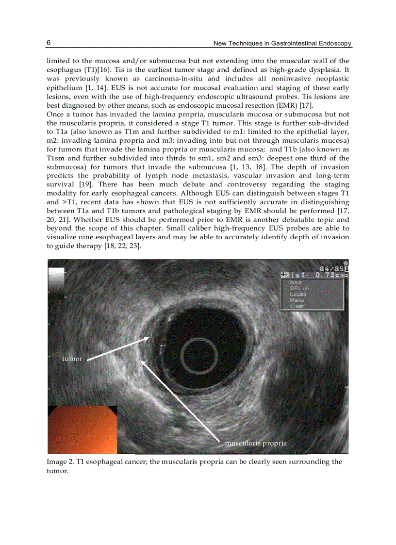 image for page New Techniques in Gastrointestinal Endoscopy