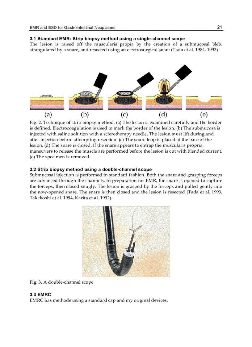 image for page New Techniques in Gastrointestinal Endoscopy