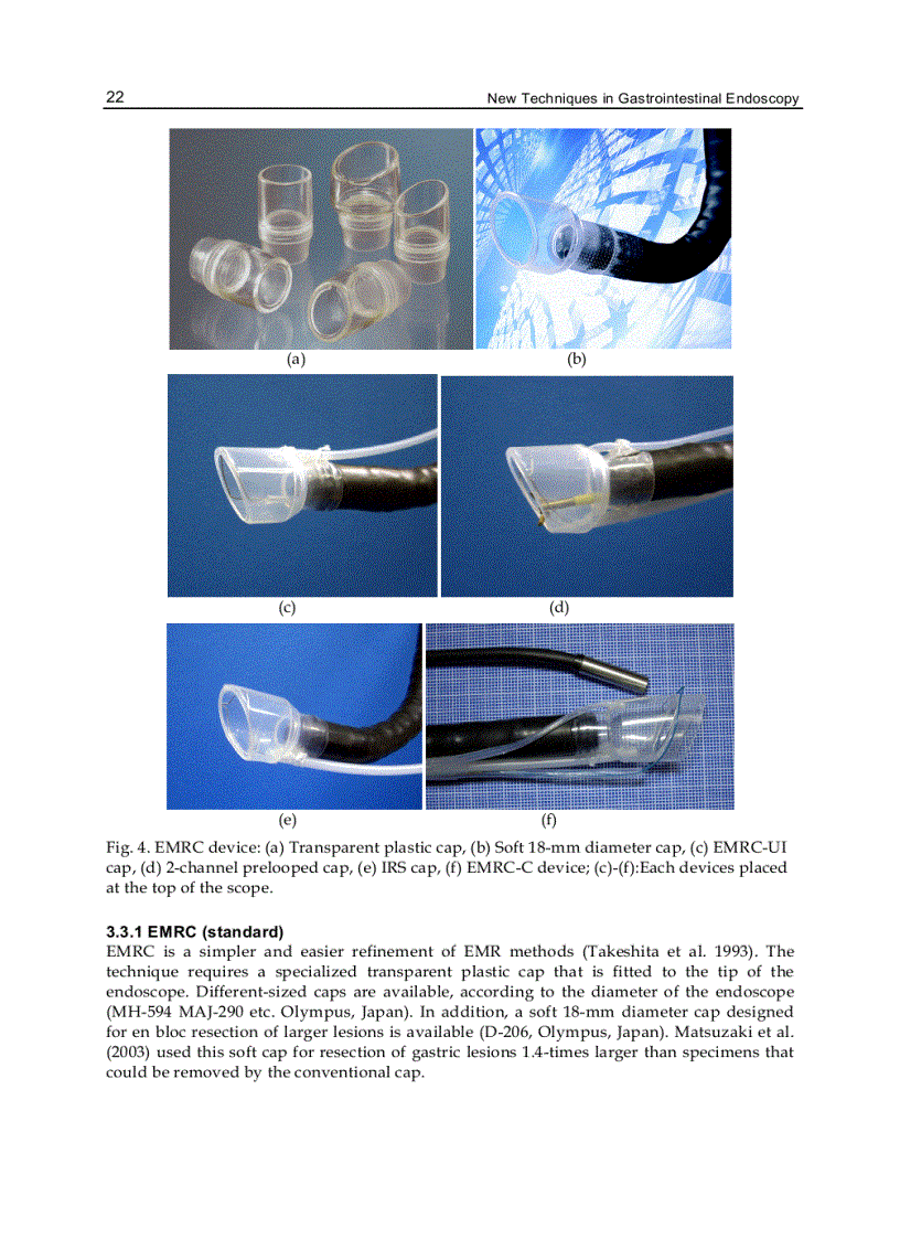 image for page New Techniques in Gastrointestinal Endoscopy