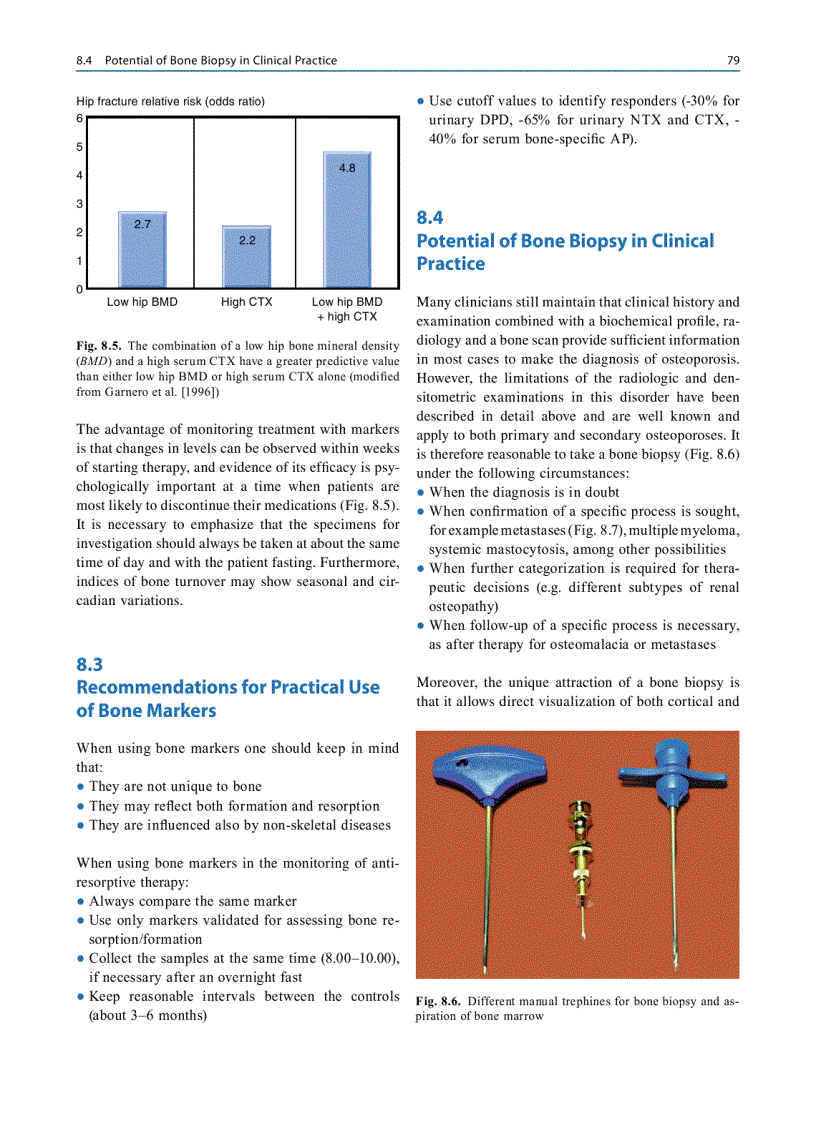 image for page Osteoporosis Diagnosis