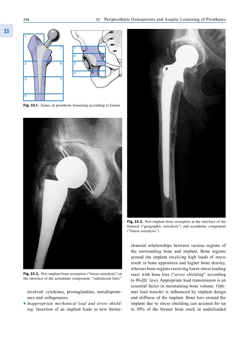 image for page Osteoporosis Diagnosis