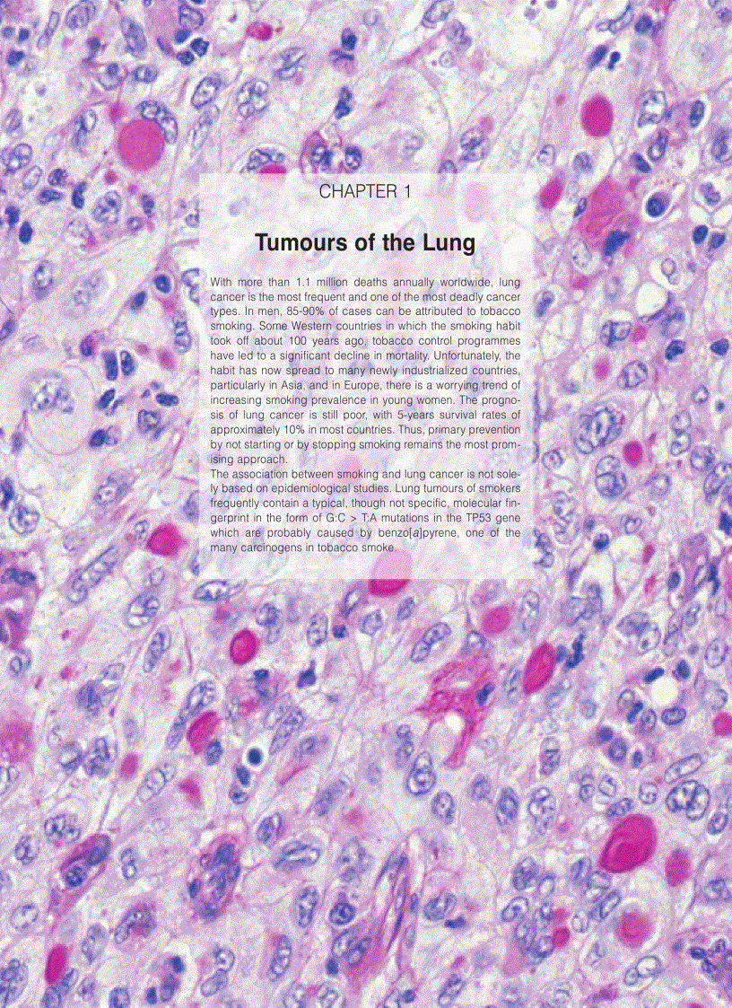 image for page Pathology Genetics Tumours of the Lung