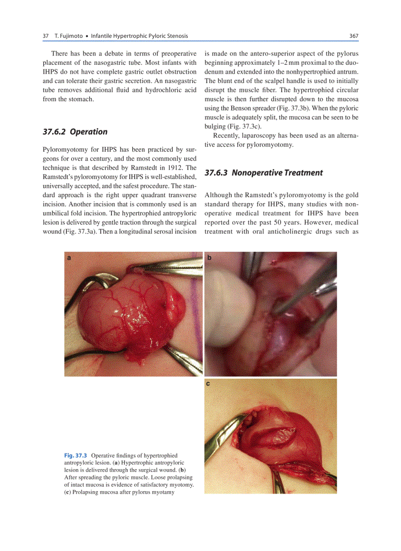 image for page Pediatric Surgery Diagnosis and Mangement