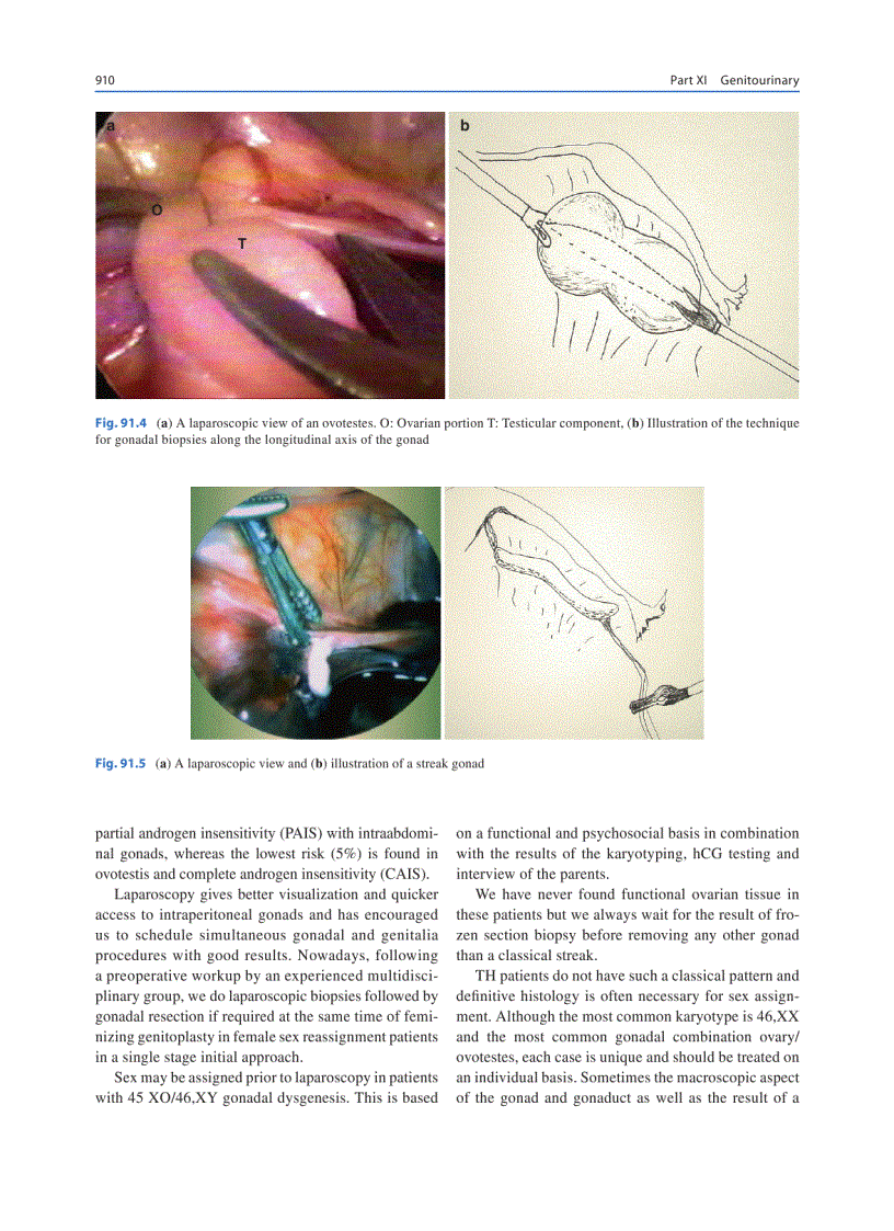 image for page Pediatric Surgery Diagnosis and Mangement