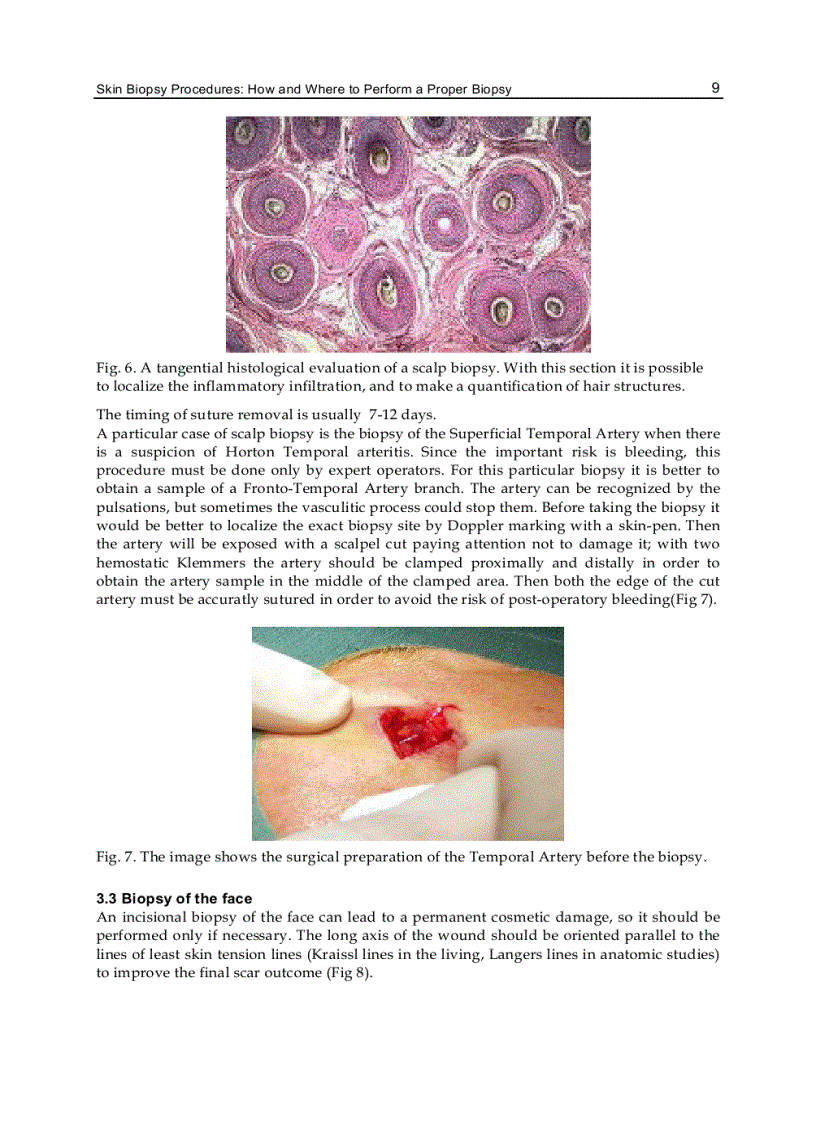 image for page Skin Biopsy Perspectives