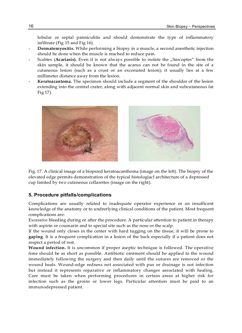 image for page Skin Biopsy Perspectives
