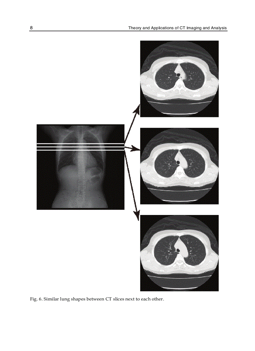 image for page Theory and Applications of CT Imaging and Analysis