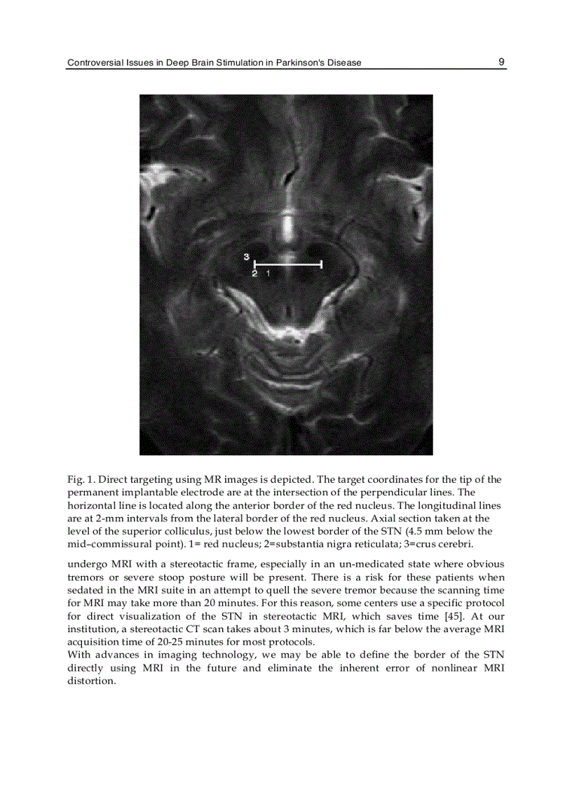 image for page Towards New Therapies for Parkinson s Disease