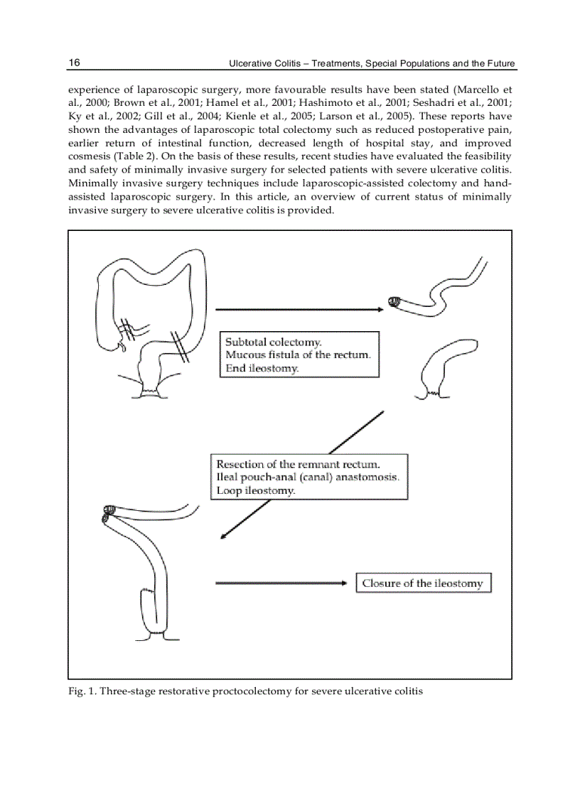 image for page Ulcerative Colitis Treatments Special Populations and the Future