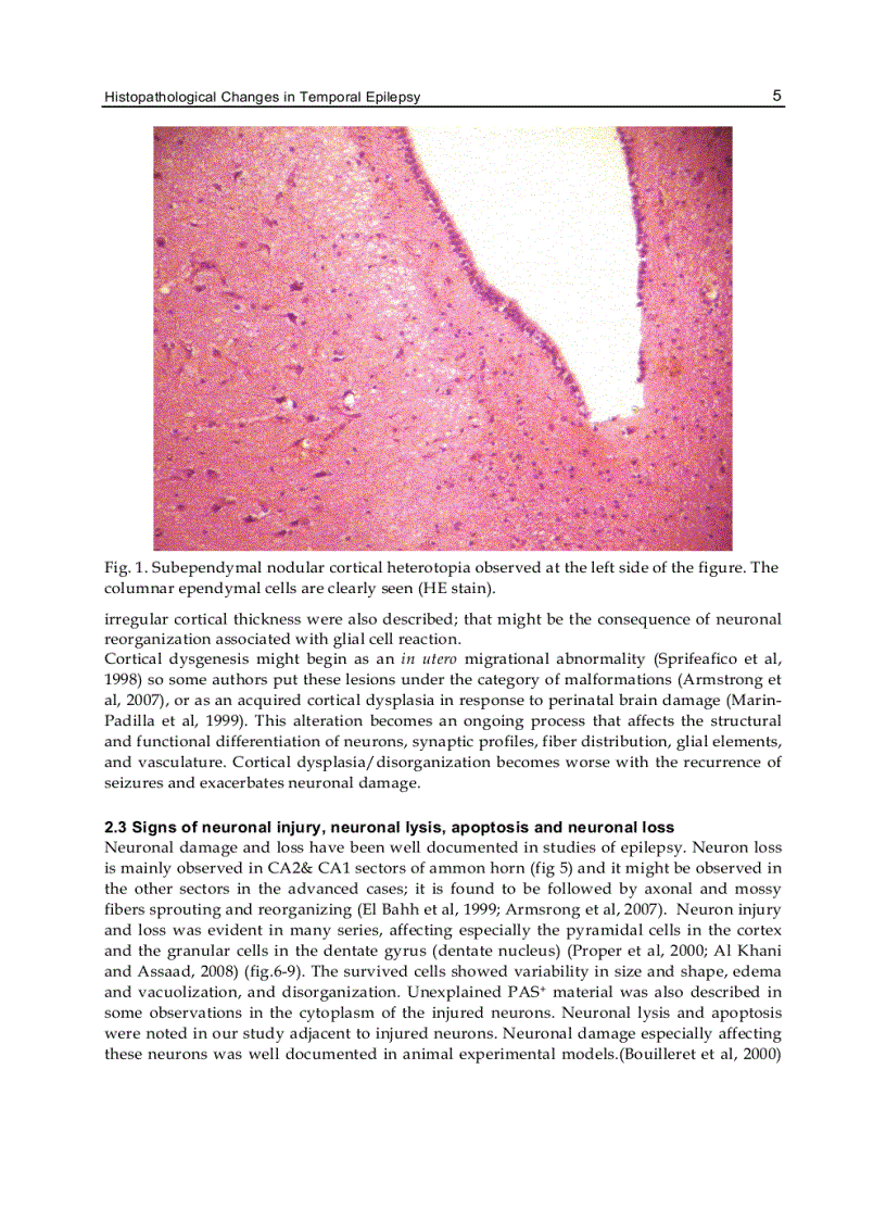 image for page Underlying Mechanisms of Epilepsy