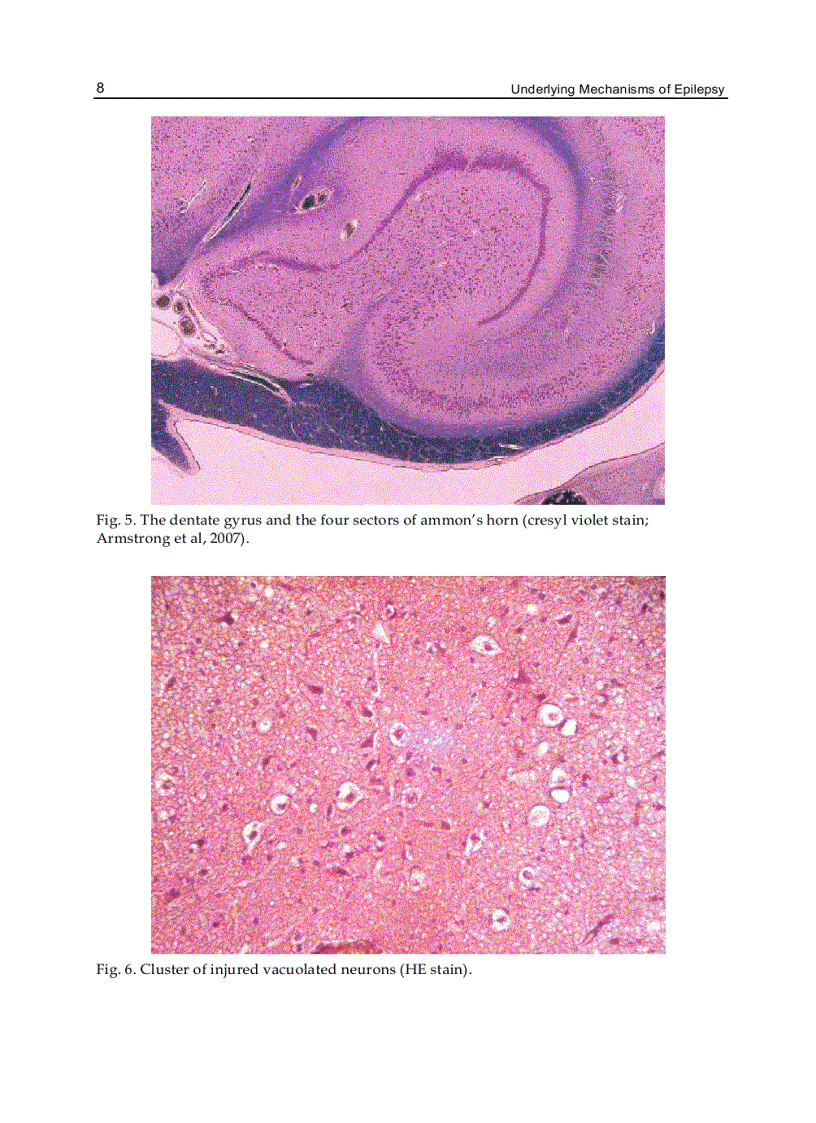 image for page Underlying Mechanisms of Epilepsy