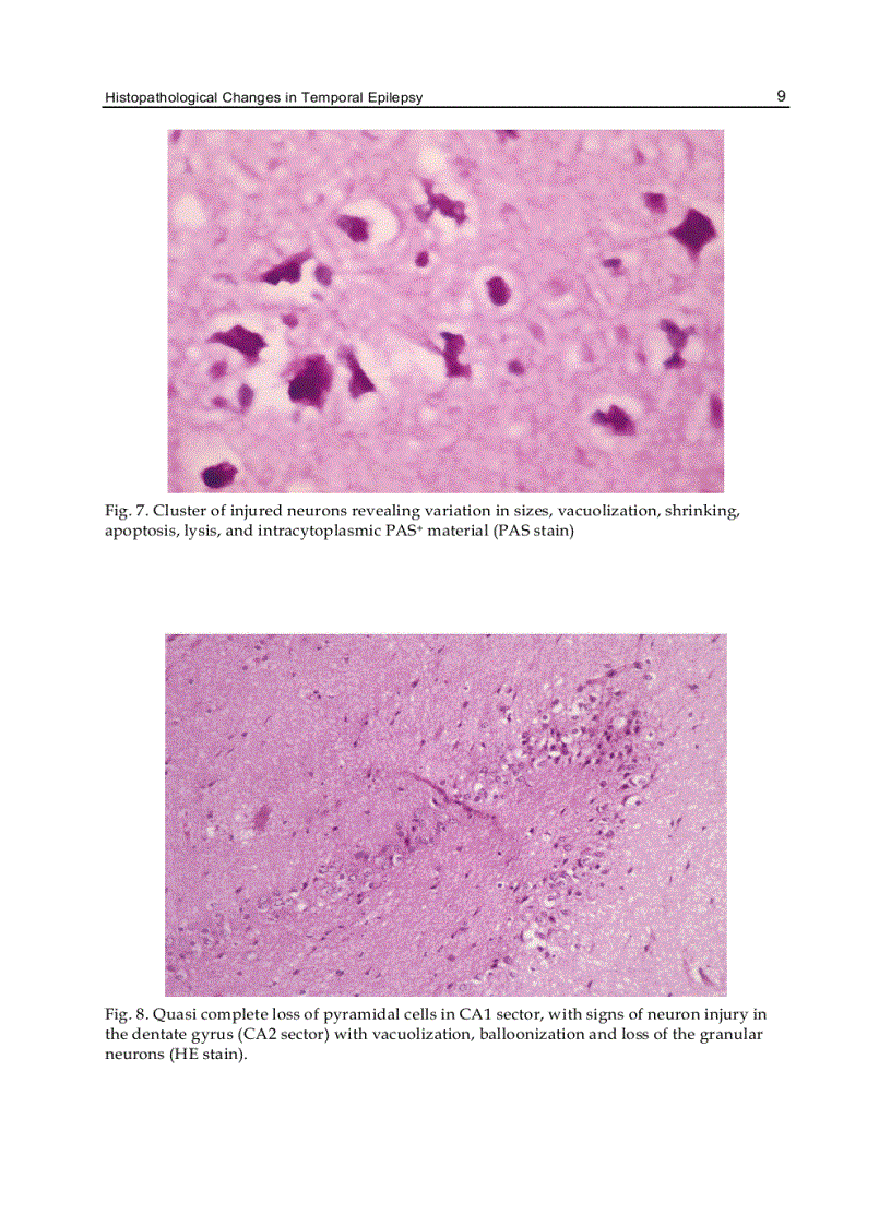 image for page Underlying Mechanisms of Epilepsy