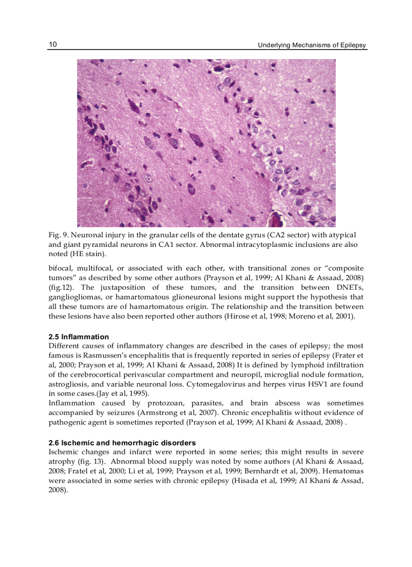 image for page Underlying Mechanisms of Epilepsy