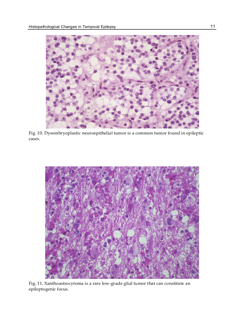 image for page Underlying Mechanisms of Epilepsy