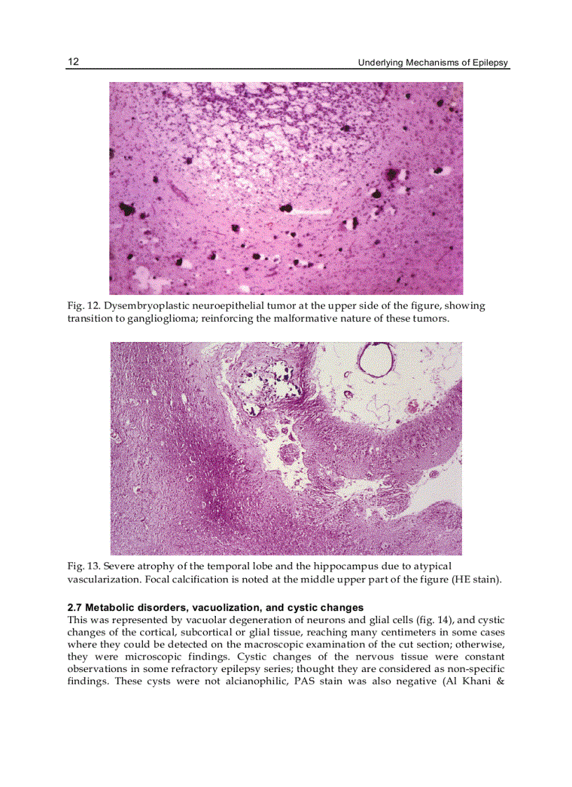 image for page Underlying Mechanisms of Epilepsy