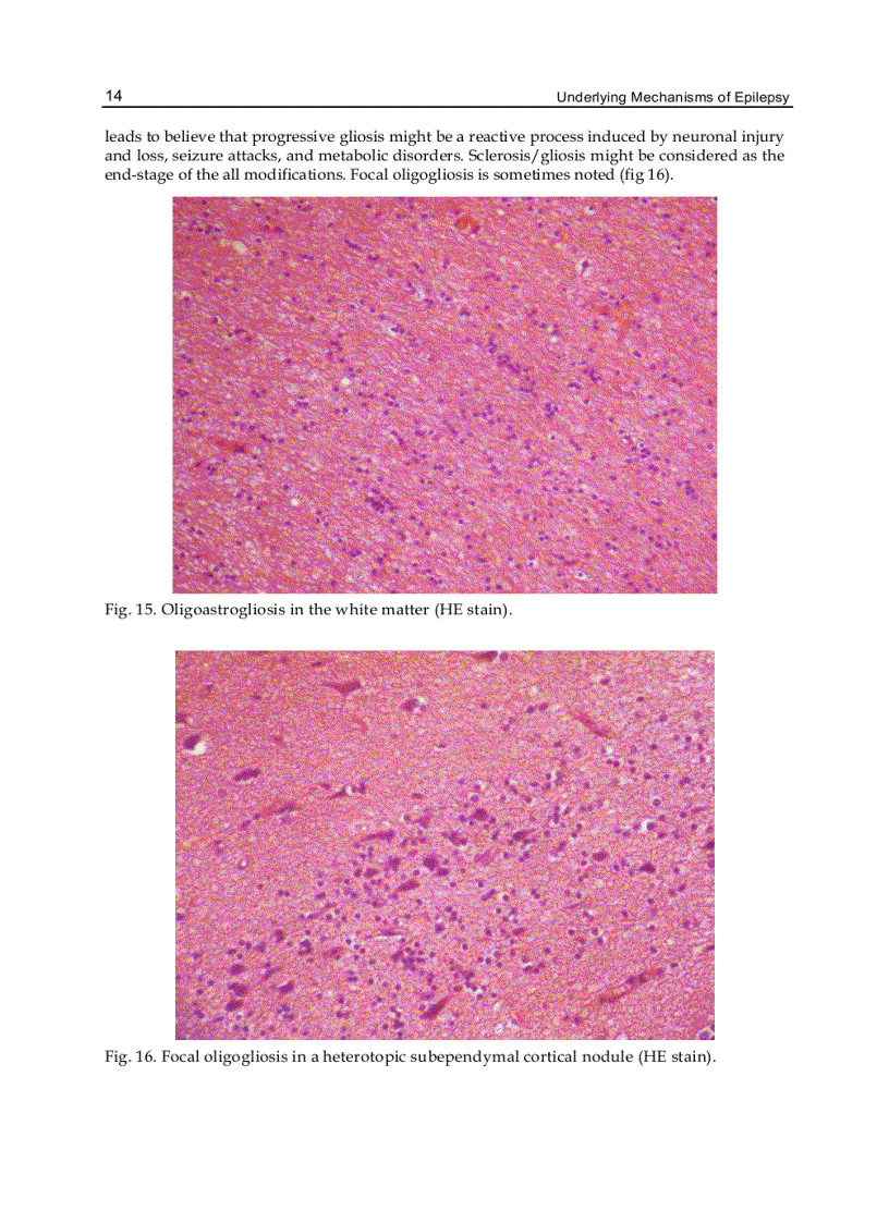image for page Underlying Mechanisms of Epilepsy