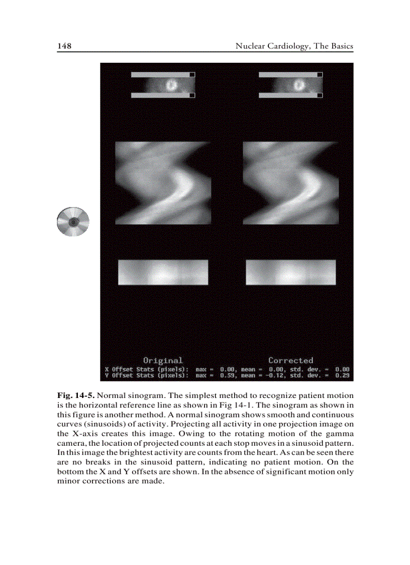 image for page Nuclear Cardiology