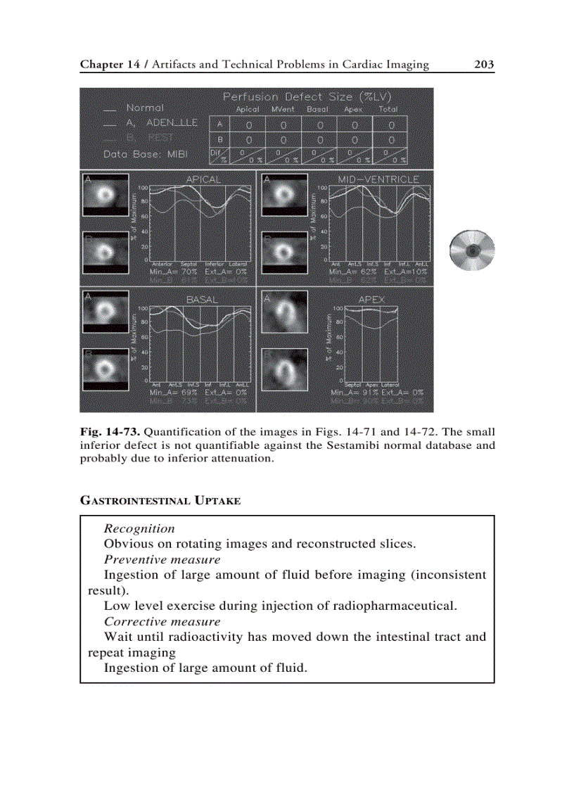 image for page Nuclear Cardiology