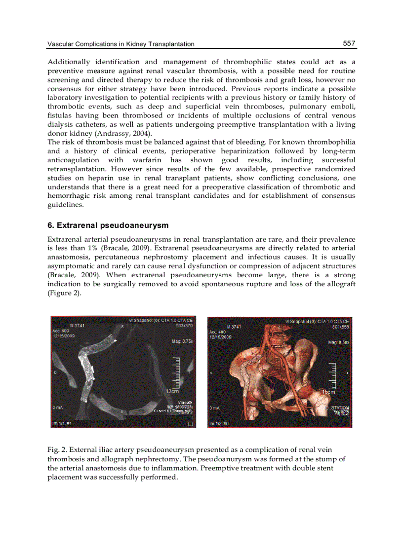image for page Understanding the Complexities of Kidney Transplantation