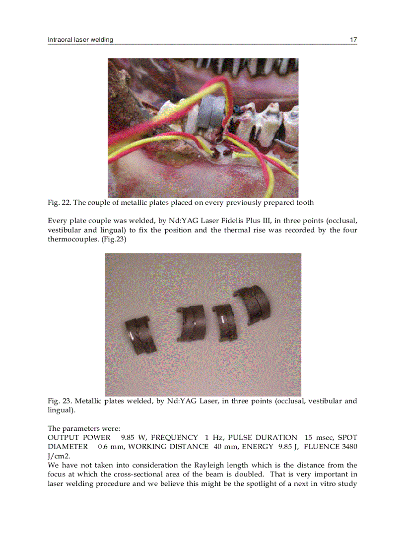 image for page Laser Welding