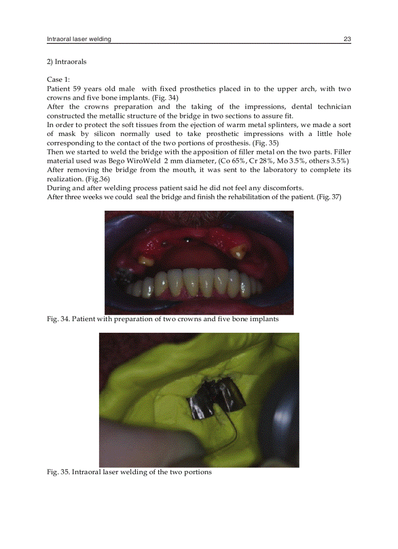 image for page Laser Welding