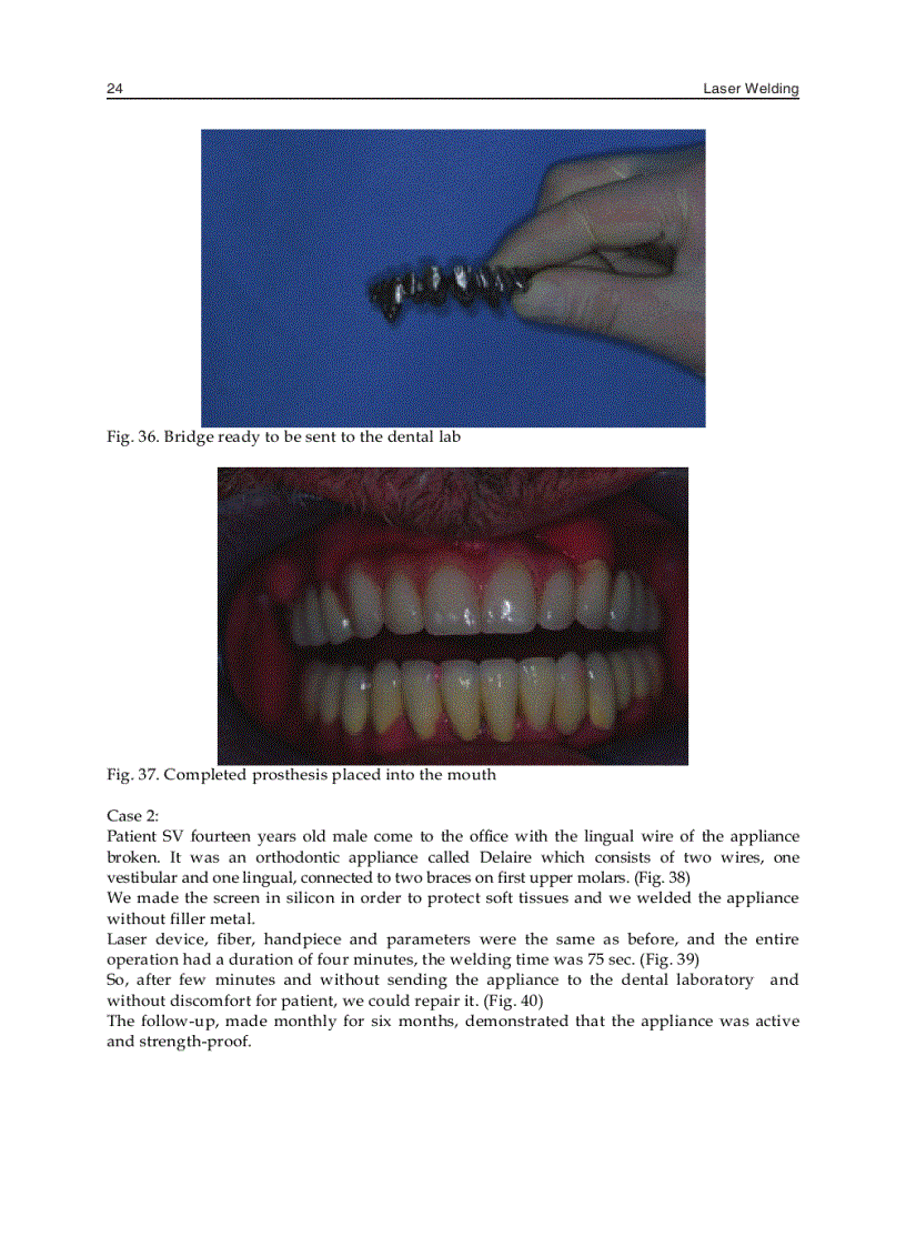 image for page Laser Welding