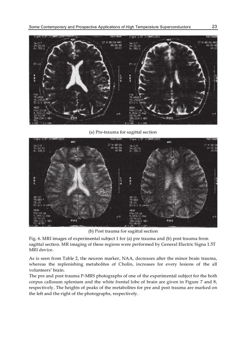 image for page Applications of High Tc Superconductivity