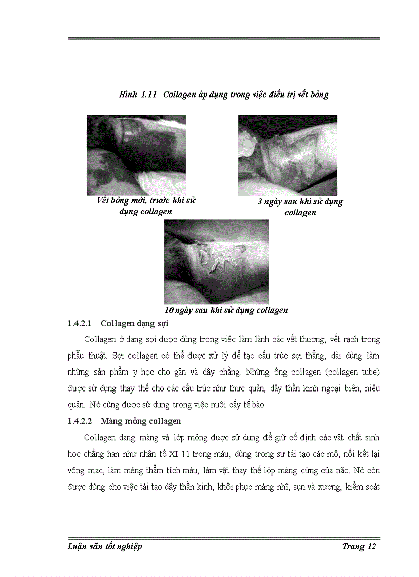 image for page Trích ly collagen từ da cá basa