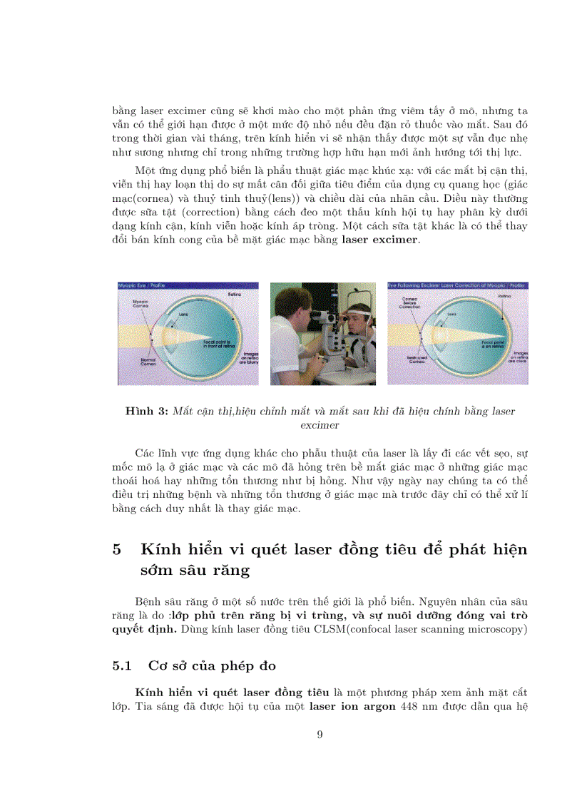 image for page Ứng dụng kỹ thuật laser trong y học