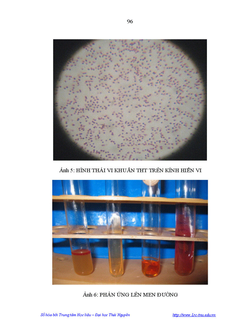 image for page Nghiên cứu một sổ đặc điểm dịch tễ bệnh tụ huyết trùng ở lợn đặc điểm sinh vật học của vi khuẩn PASTEURELLA MULTOCIDA gây bệnh tụ huyết trùng ở lợn tại Tỉnh Phú Thọ và Biện pháp phòn