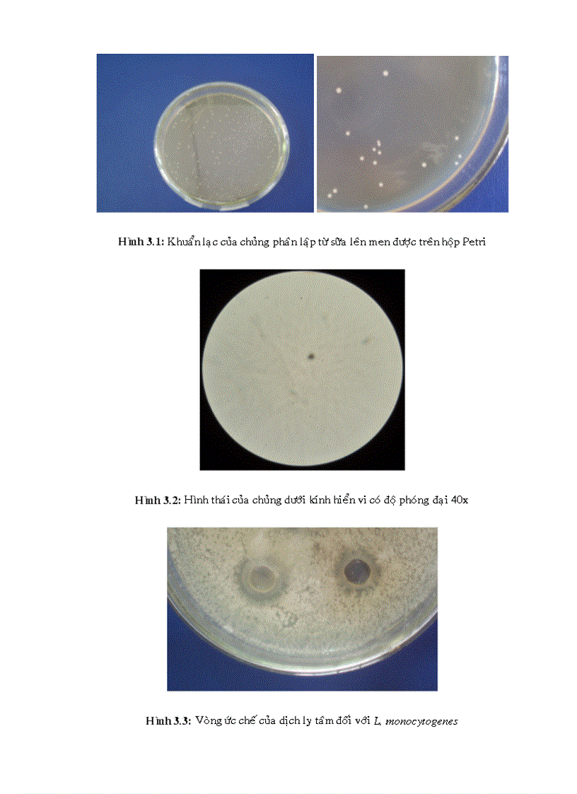 image for page Phân lập chủng vi khuẩn lactic và khảo sát khả năng sinh tổng hợp bacterioncin