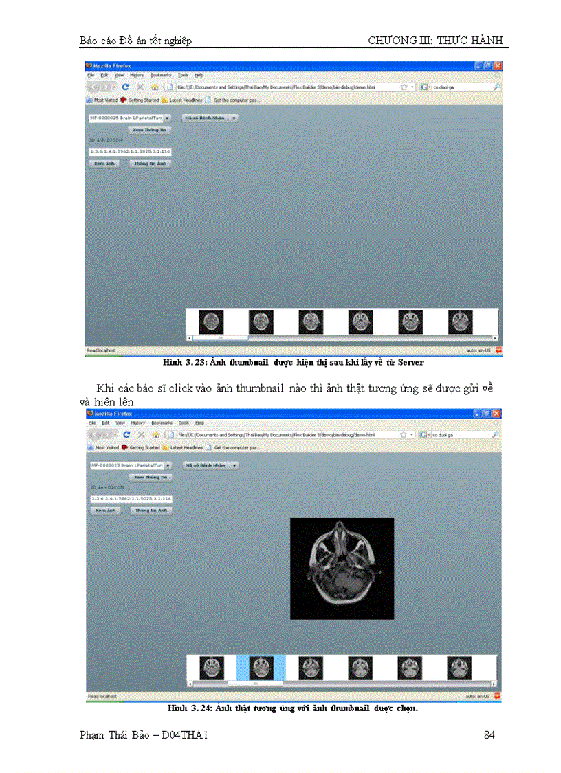image for page Xây dựng media server ứng dụng trong hội chẩn từ xa