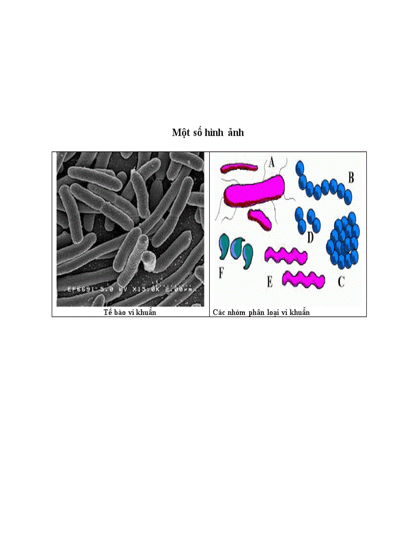 image for page Bệnh sùi cành chè Bacterium sp