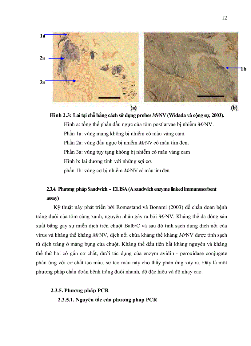 image for page ỨNG DỤNG KỸ THUẬT RT PCR XÁC ĐỊNH Macrobrachium rosenbergii NODAVIRUS MrNV VÀ EXTRA SMALL VIRUS XSV TRÊN TÔM CÀNG XANH Macrobrachium rosenbergii