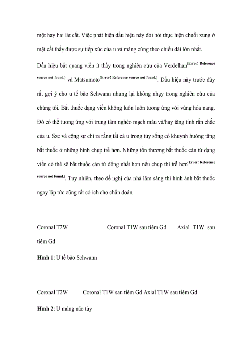 image for page Đặc điểm hình ảnh cộng hưởng từ u tế bào schwann và u màng não trong màng cứng ngoài tủy