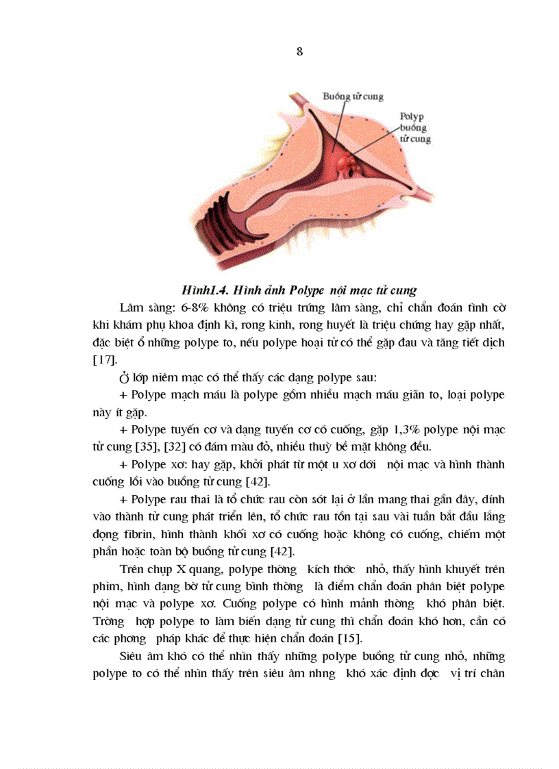 image for page Đối chiếu hình ảnh X quang siêu âm với hình ảnh buồng tử cung qua soi buồng tử cung