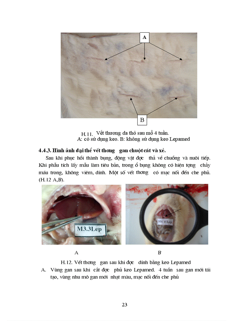 image for page Nghiên cứu tính phù hợp sinh học tính kháng khuẩn và khả năng liền mô của keo phẫu thuật Lepamed
