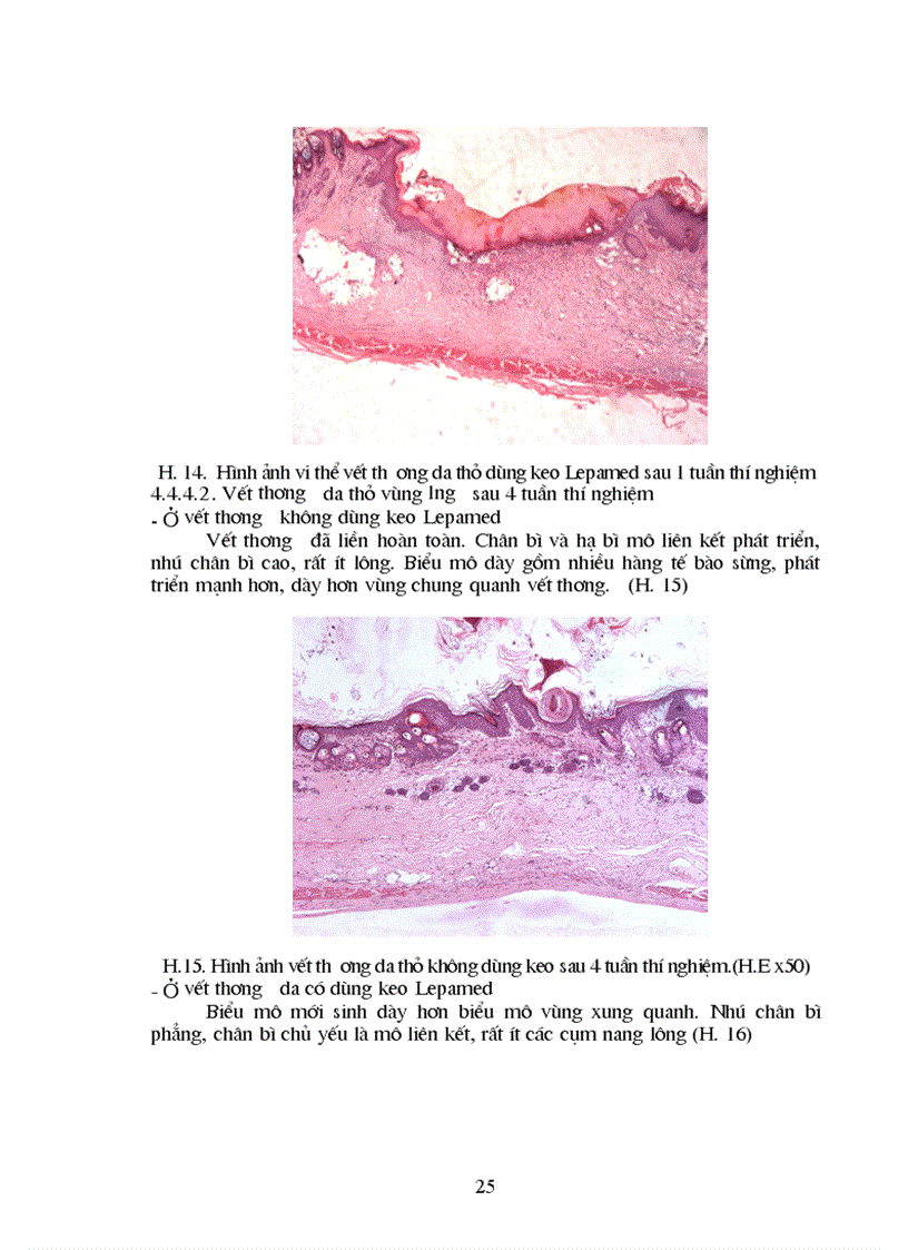 image for page Nghiên cứu tính phù hợp sinh học tính kháng khuẩn và khả năng liền mô của keo phẫu thuật Lepamed