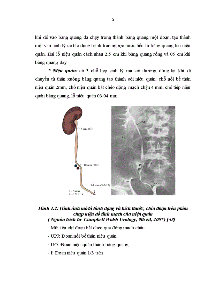image for page Đánh giá kết quả điều trị sỏi niệu quản bằng phương pháp tán sỏi nội soi ngược dòng trên máy Lithoclast tại bệnh viện Thanh Nhàn