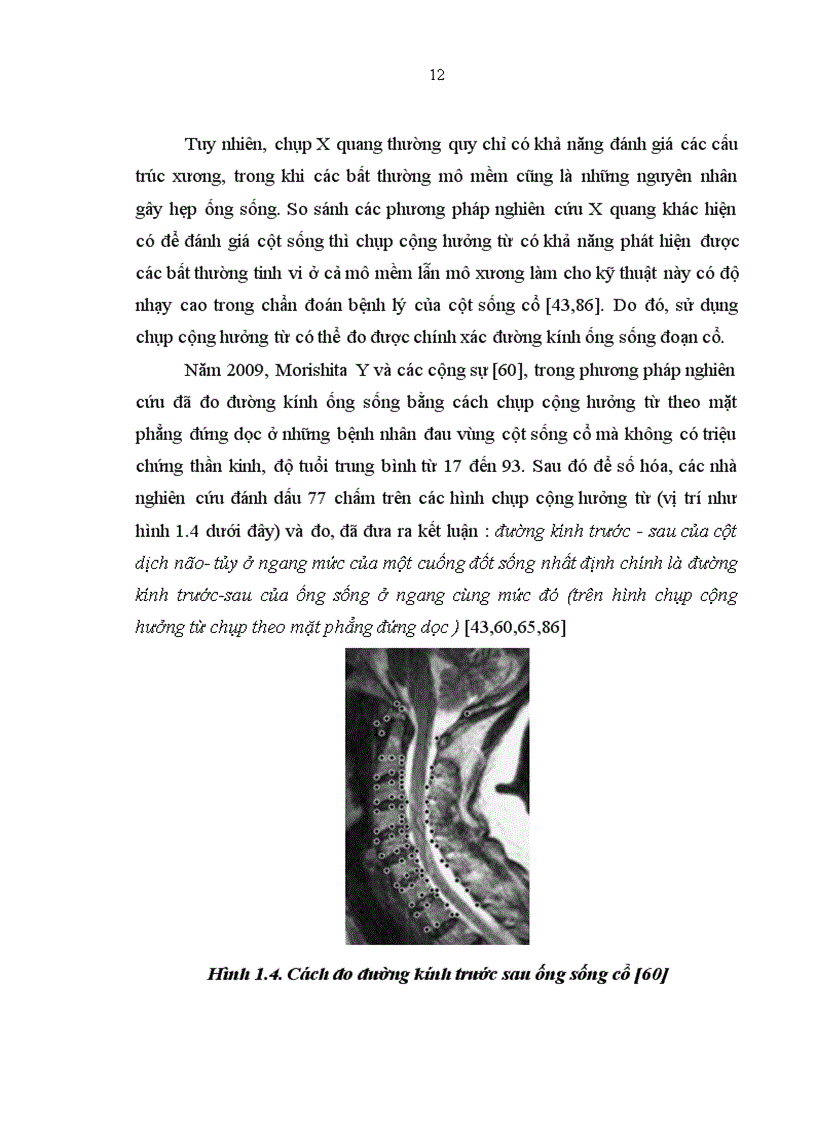 image for page Nghiên cứu các đặc điểm lâm sàng và hình ảnh chụp cộng hưởng từ của bệnh nhân hẹp ống sống cổ tại Khoa Thần kinh Bệnh viện Bạch Mai