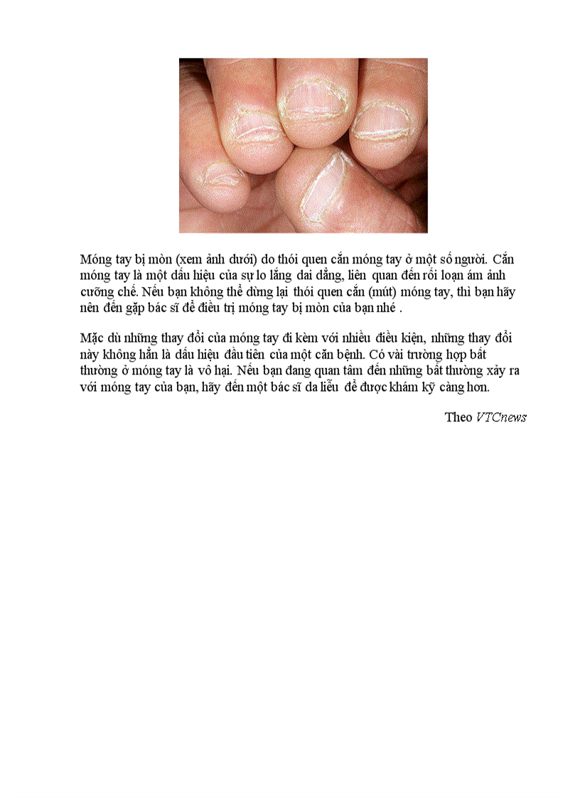 image for page Chẩn bệnh qua 9 kiểu móng tay