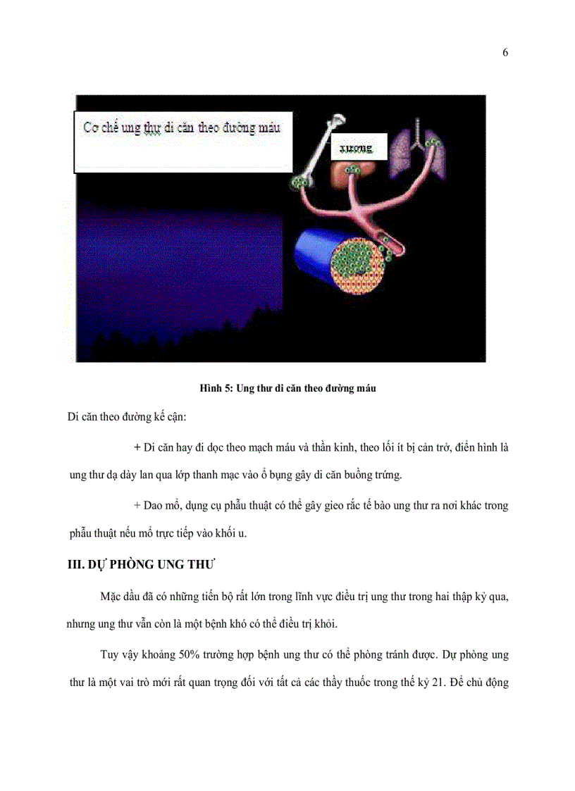 image for page GT ung thư