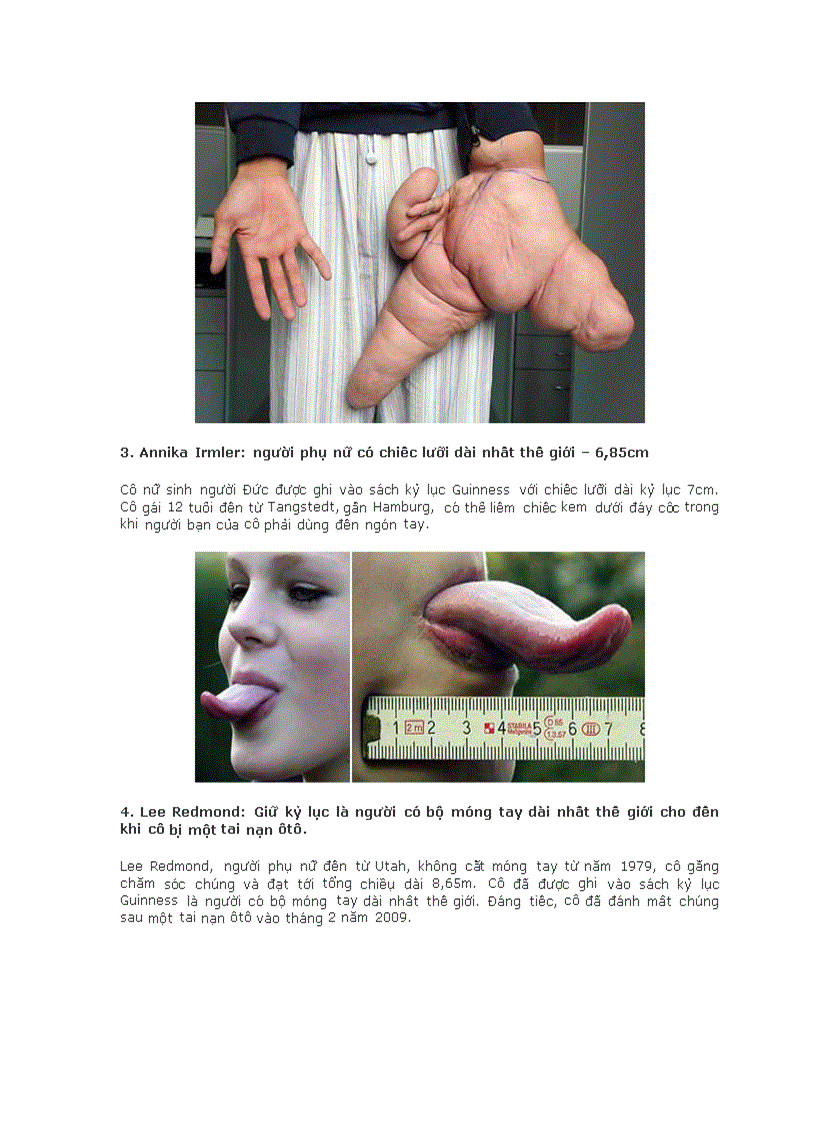 image for page 10 người sở hữu những bộ phận dị thường
